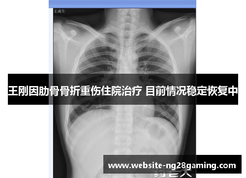 王刚因肋骨骨折重伤住院治疗 目前情况稳定恢复中 王刚因肋骨骨折重伤住院治疗 目前情况稳定恢复中
